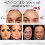 NEWKEY Led Face Mask Light Therapy, 7 Led Light Therapy Facial Skin Care Mask - Blue & Red Light for Acne Photon Mask - Korea PDT Technology for Acne Reduction - Image 2